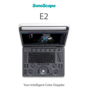 laptop-ultrasound-machine-medical-equipment-bionex-E2