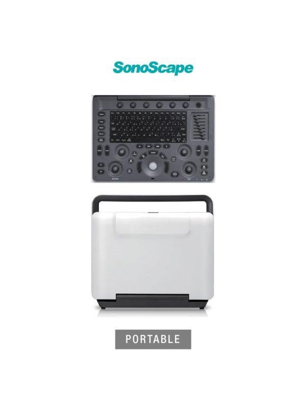 SonoScape E2 Portable | Laptop Styled Ultrasound Machine - Image 2