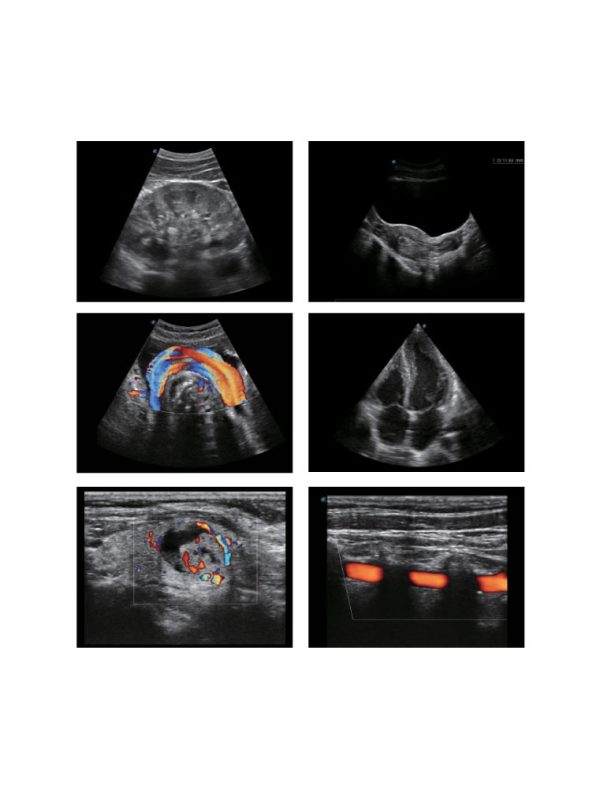 SonoScape E2 Portable | Laptop Styled Ultrasound Machine - Image 3