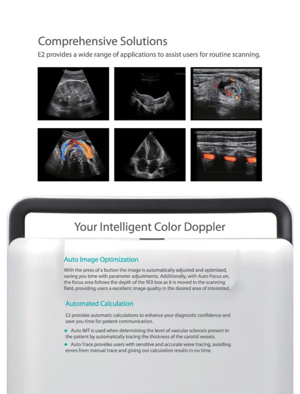 SonoScape E2 Portable | Laptop Styled Ultrasound Machine - Image 5