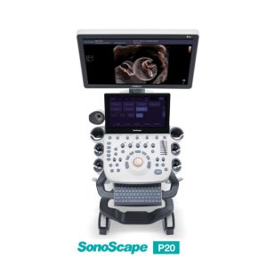 ultrasound-machine-medical-equipment