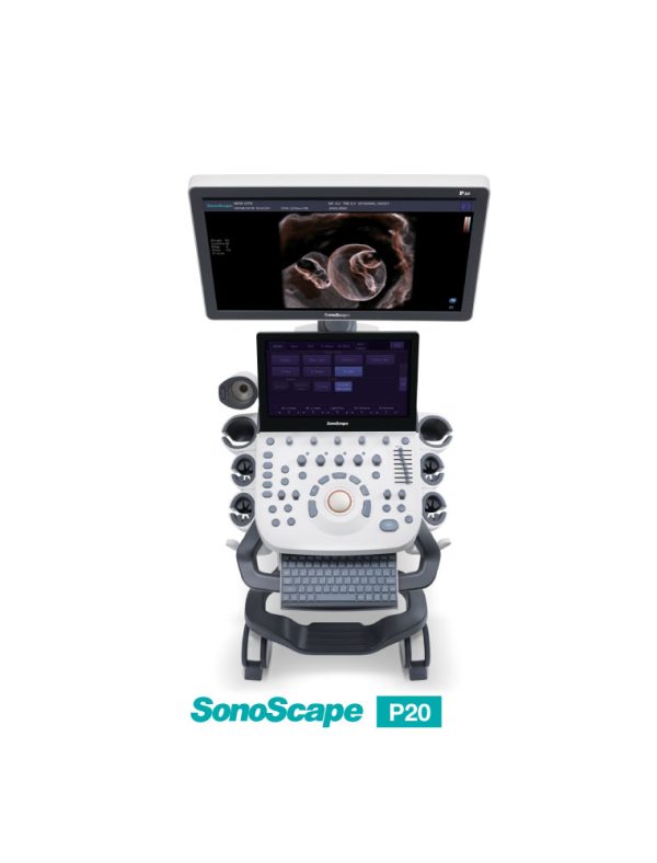 ultrasound-machine-medical-equipment