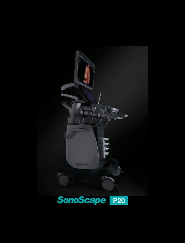 SonoScape P20 - Value & Significance - Image 3