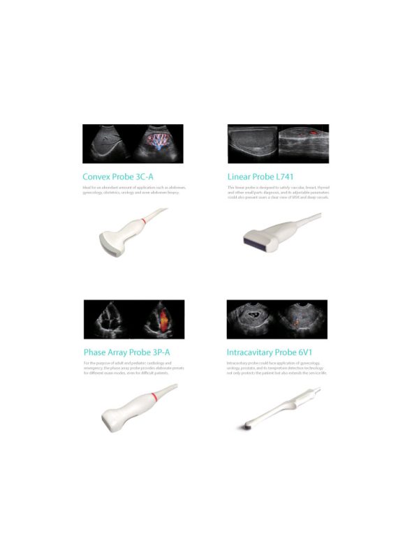 SonoScape P10 - Ultrasound Solutions with Flexibility - Image 3