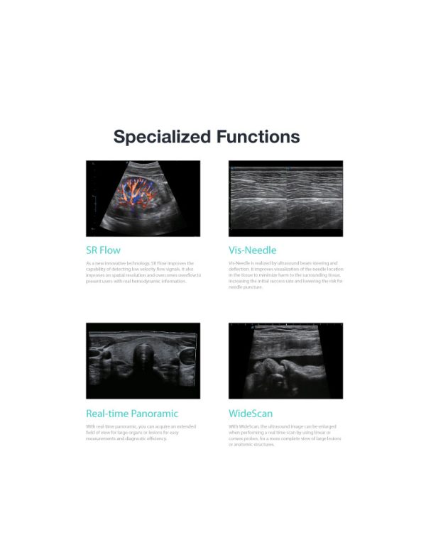SonoScape P10 - Ultrasound Solutions with Flexibility - Image 5
