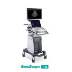 SonoScape P15 - Enhance Your Ultrasound Exam