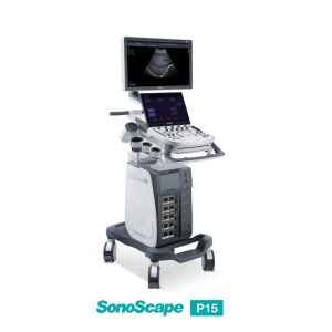 SonoScape P15 - Enhance Your Ultrasound Exam