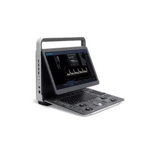Ultrasound Machine E1