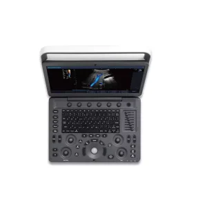 Ultrasound Machine E2