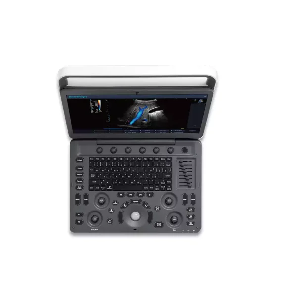 Ultrasound Machine E2