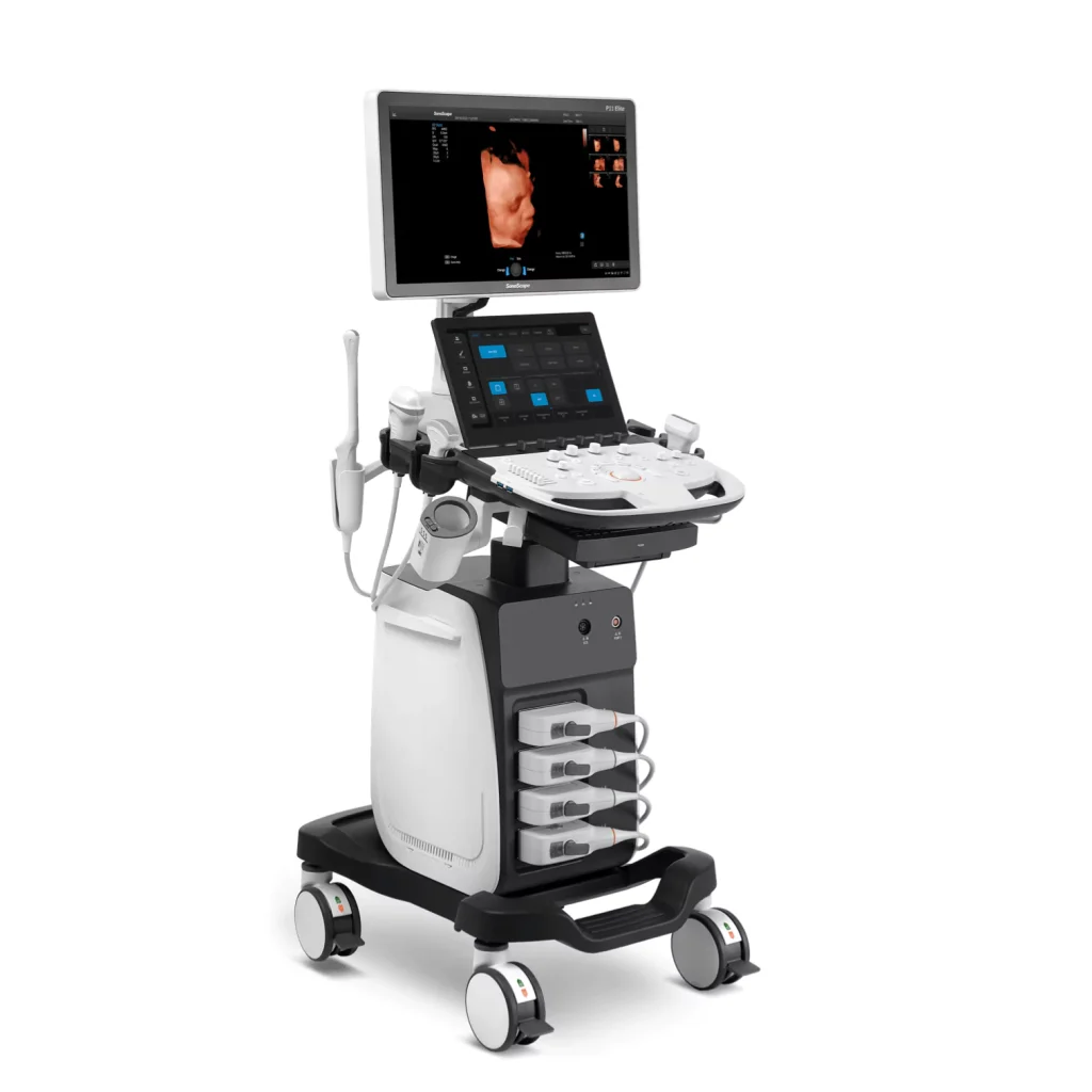 Ultrasound Machine P11 Elite