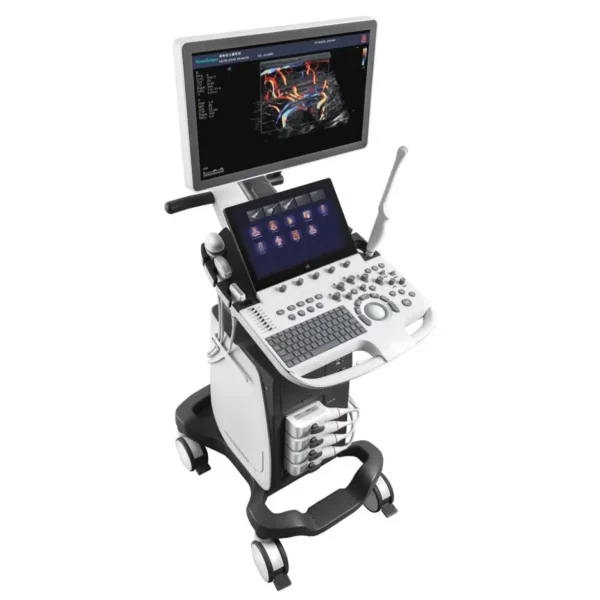Ultrasound Machine P20
