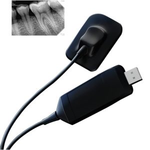 RVG Sensor