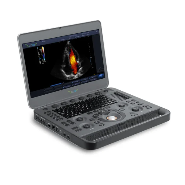 Ultrasound Machine X5