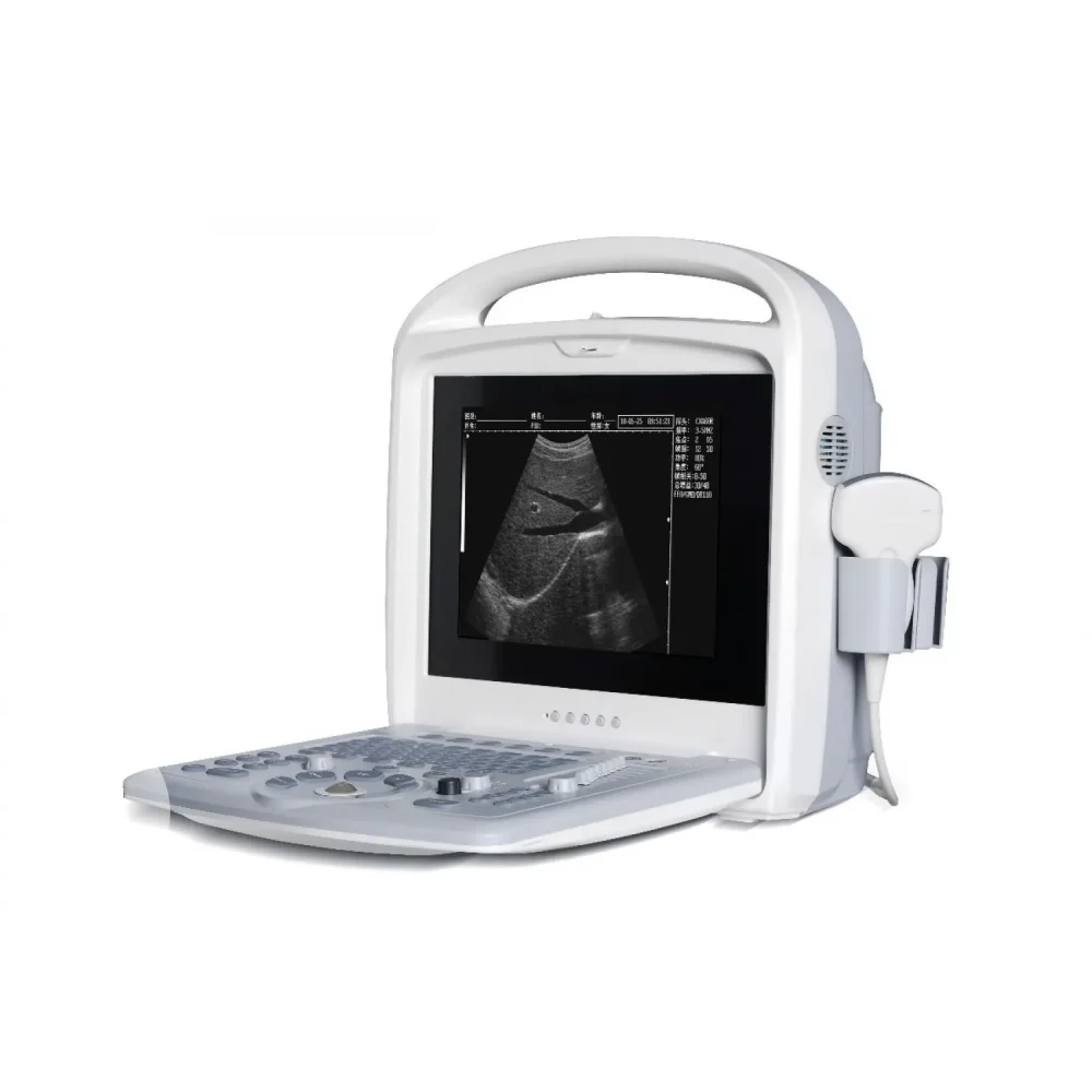 Ultrasound Scanner BLS 820
