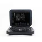 Digital Diagnostic Ultrasound System PU-DL151A