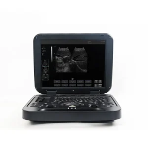 Digital Diagnostic Ultrasound System PU-DL151A